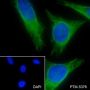 Anti-Vimentin Rabbit mAb