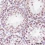 Anti-HDAC1 Mouse mAb