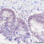 Anti-PABPN1 Mouse mAb
