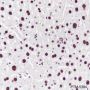 Anti-PABPN1 Mouse mAb