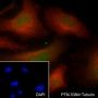 Anti-PABPN1 Mouse mAb