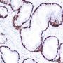 Anti-Keratin 14 Rabbit mAb