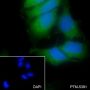 Anti-Keratin 14 Rabbit mAb