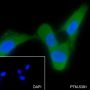 Anti-Keratin 14 Rabbit mAb
