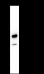 Anti-Tyrosine Hydroxylase Mouse mAb