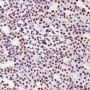 Anti-SUMO-2/3 Mouse mAb (C-terminal)
