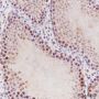 Anti-SUMO-2/3 Mouse mAb (C-terminal)