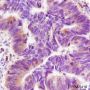 Anti-Thymidylate Synthase Mouse mAb