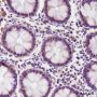 Anti-PI3 Kinase p85 beta Mouse mAb