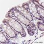 Anti-PI3 Kinase p85 beta Mouse mAb
