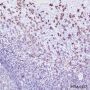 Anti-CD20 Rabbit mAb