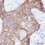 Anti-EGFR Rabbit mAb