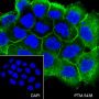 Anti-EGFR Rabbit mAb