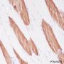 Anti-Myosin Light Chain 3 Rabbit mAb