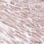 Anti-Myosin Light Chain 3 Rabbit mAb