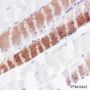 Anti-Myosin Light Chain 3 Rabbit mAb