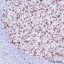 Anti-PD1 Rabbit mAb