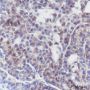 Anti-Met Rabbit mAb