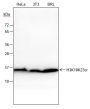 Anti-Crotonyl-histone H3 (Lys18/23) Rabbit mAb