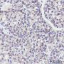 Anti-EGFR Rabbit mAb
