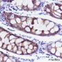 Anti-Keratin 20 Rabbit mAb