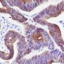 Anti-Keratin 20 Rabbit mAb
