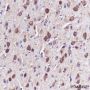 Anti-Hsc70-Interacting Protein / Hip Rabbit mAb