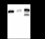 Anti-HER2/ErbB2 Rabbit mAb