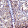 Anti-HER2/ErbB2 Rabbit mAb