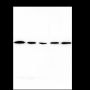 Anti-G6PD Mouse mAb