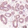 Anti-G6PD Mouse mAb