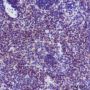 Anti-SQSTM1/p62 Rabbit mAb