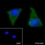 Anti-SQSTM1/p62 Rabbit mAb