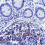 Anti-CD3 gamma Rabbit mAb