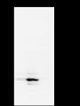 Anti-CD3 gamma Rabbit mAb