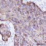 Anti-Keratin HMW Rabbit mAb