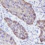 Anti-Keratin 5/6 Rabbit mAb