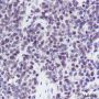 Anti-DCPS Mouse mAb