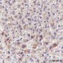 Anti-ANGPTL3 Rabbit mAb