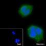 Anti-ANGPTL3 Rabbit mAb