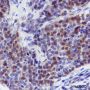 Anti-CRABP2 Mouse mAb