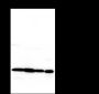 Anti-UBC12 Mouse mAb
