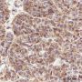 Anti-UBC12 Mouse mAb