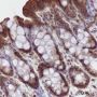 Anti-UBC12 Mouse mAb