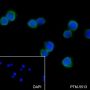 Anti-UBC12 Mouse mAb