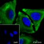 Anti-NSE Rabbit mAb