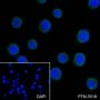 Anti-NSE Rabbit mAb