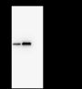 Anti-NSE Rabbit mAb