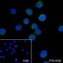 Anti-CD11a Mouse mAb