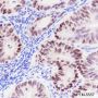 Anti-SMARCD3 Rabbit mAb